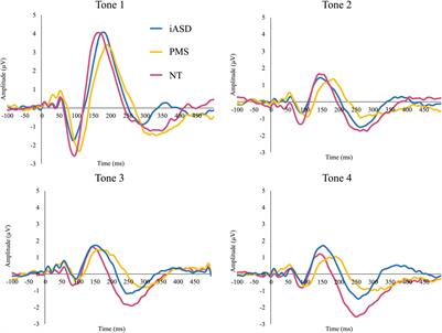 Neural Markers of Auditory Response and Habituation in Phelan-McDermid Syndrome